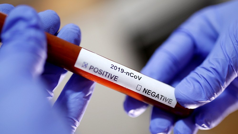 Donald Trump denies the US has most coronavirus deaths
